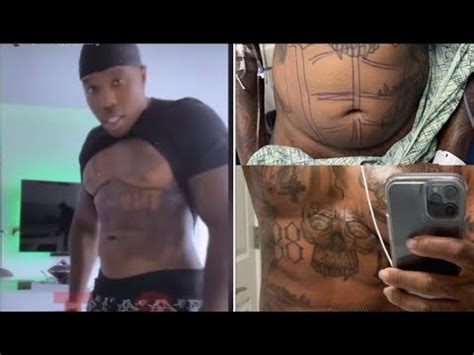 bandman kevo before and after surgery|Bandman Kevo Says He Got Liposuction Because He Was。